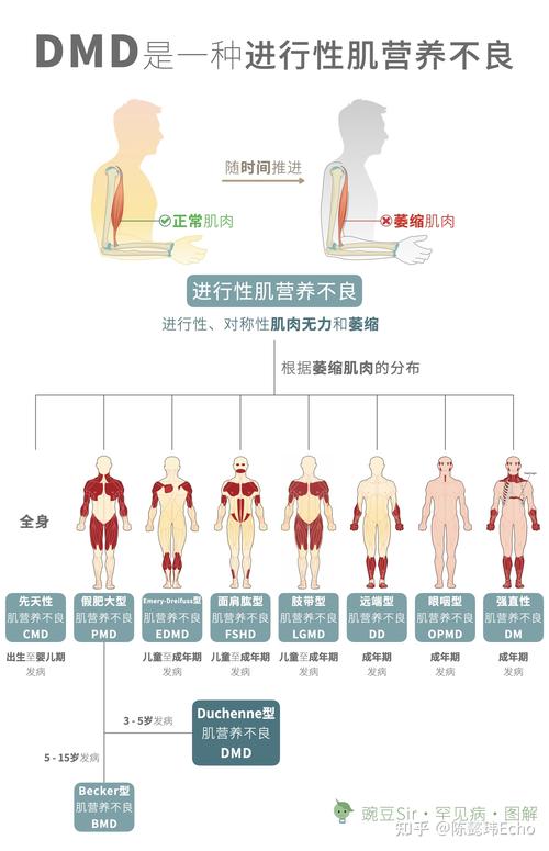 肌肉缺营养的症状（肌肉缺营养的症状表现）